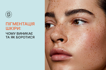 Пігментація шкіри: чому виникає та як боротися