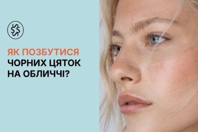 Як позбутися чорних цяток на обличчі?