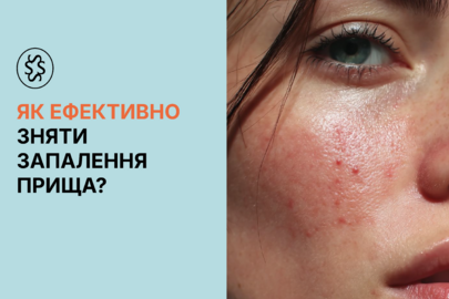 Як ефективно зняти запалення прища?