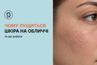 Чому лущиться шкіра на обличчі та що робити
