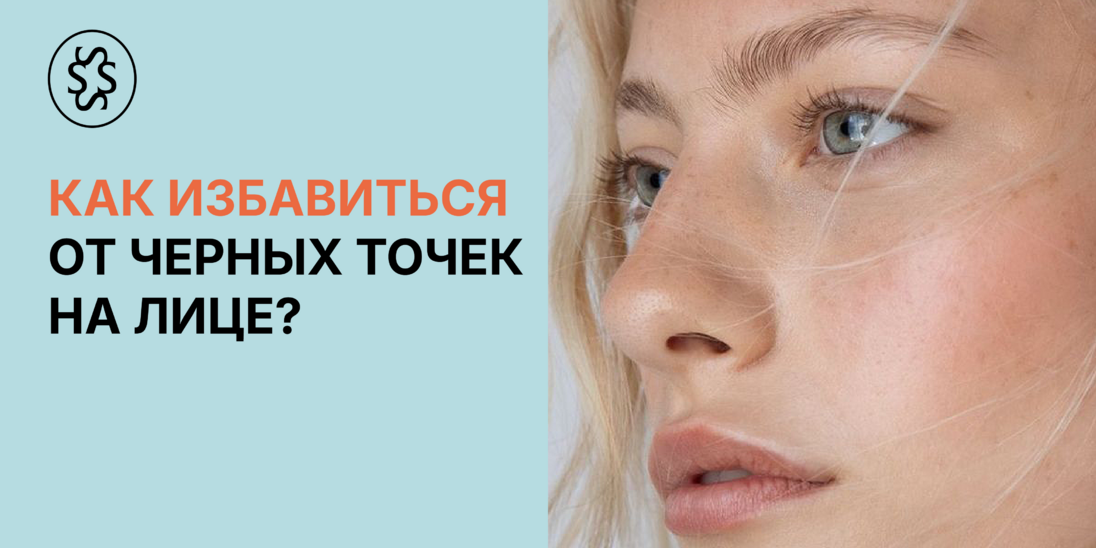 Как избавиться от черных точек на лице?