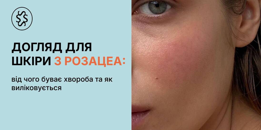 Догляд для шкіри з розацеа: від чого буває хвороба та як виліковується