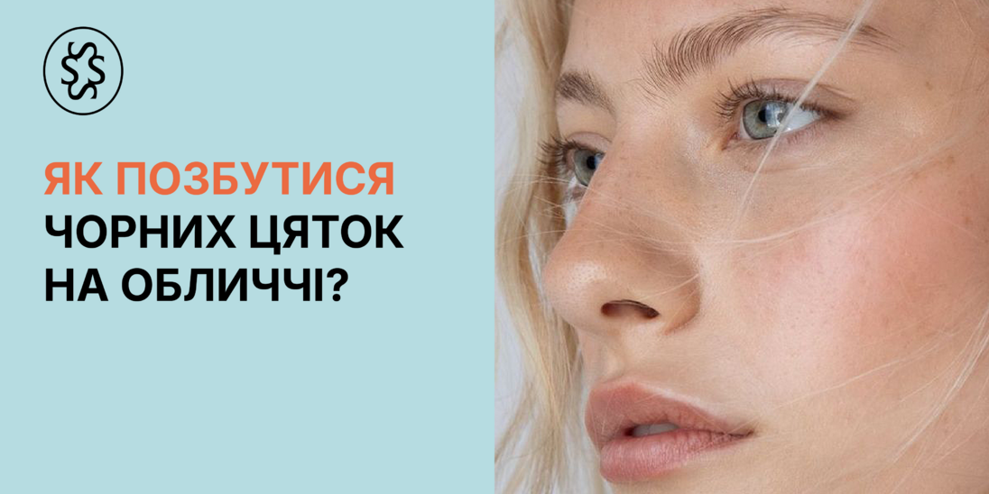 Як позбутися чорних цяток на обличчі?