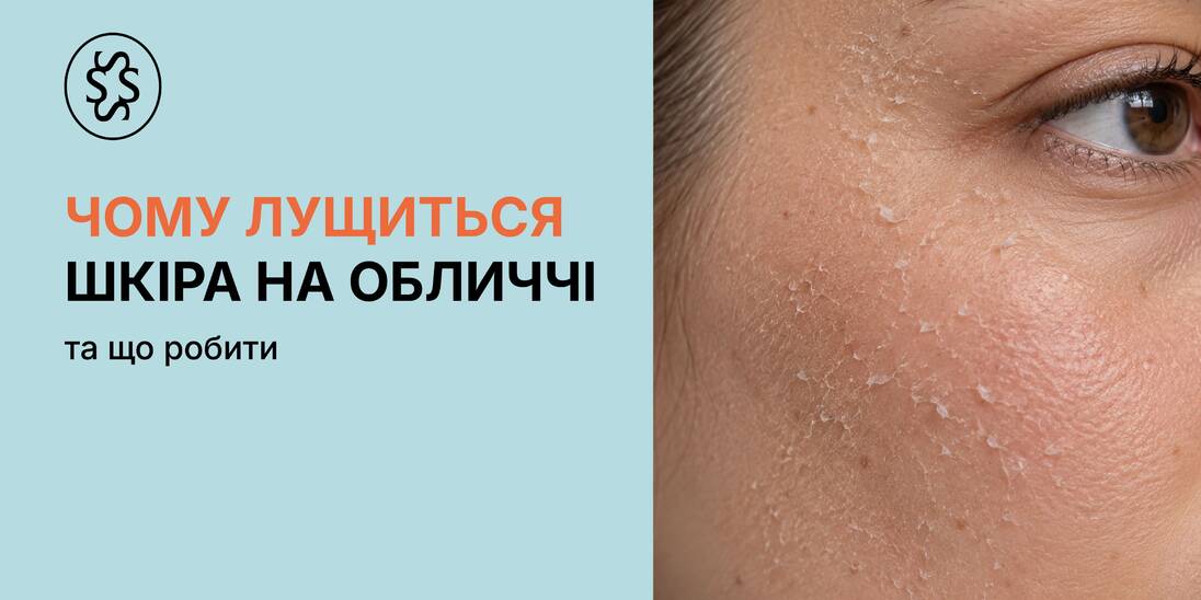 Чому лущиться шкіра на обличчі та що робити